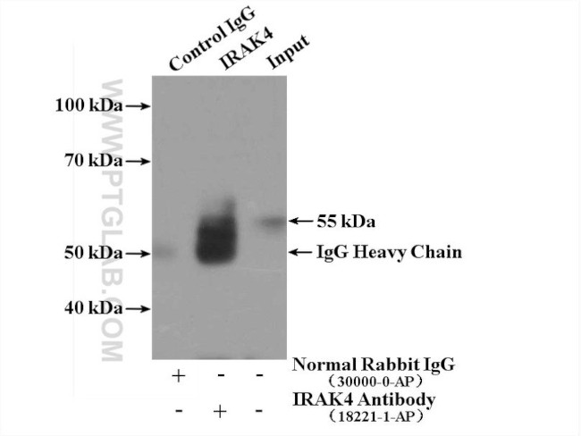 IRAK4 Antibody in Immunoprecipitation (IP)