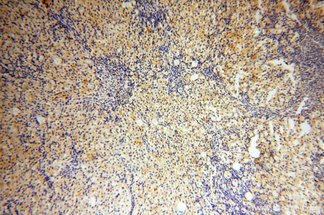 NFATC3 Antibody in Immunohistochemistry (Paraffin) (IHC (P))