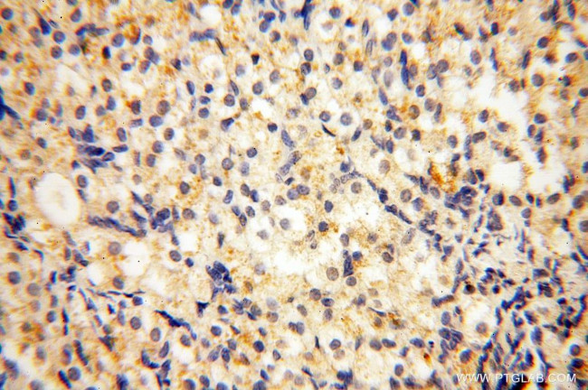 NFATC3 Antibody in Immunohistochemistry (Paraffin) (IHC (P))