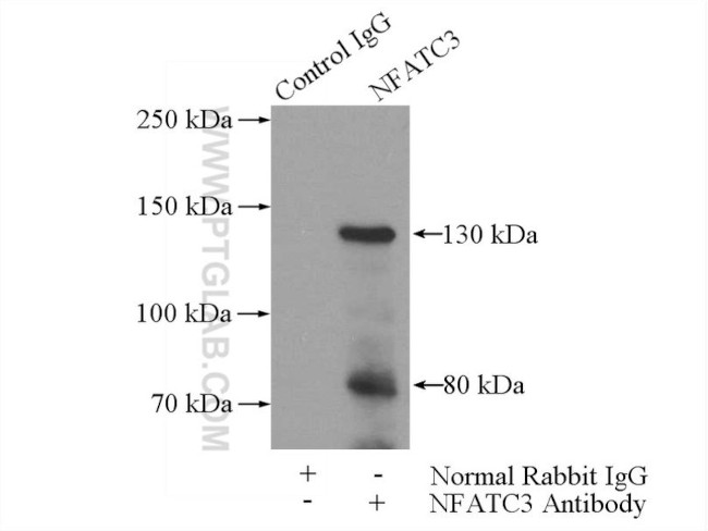 NFATC3 Antibody in Immunoprecipitation (IP)