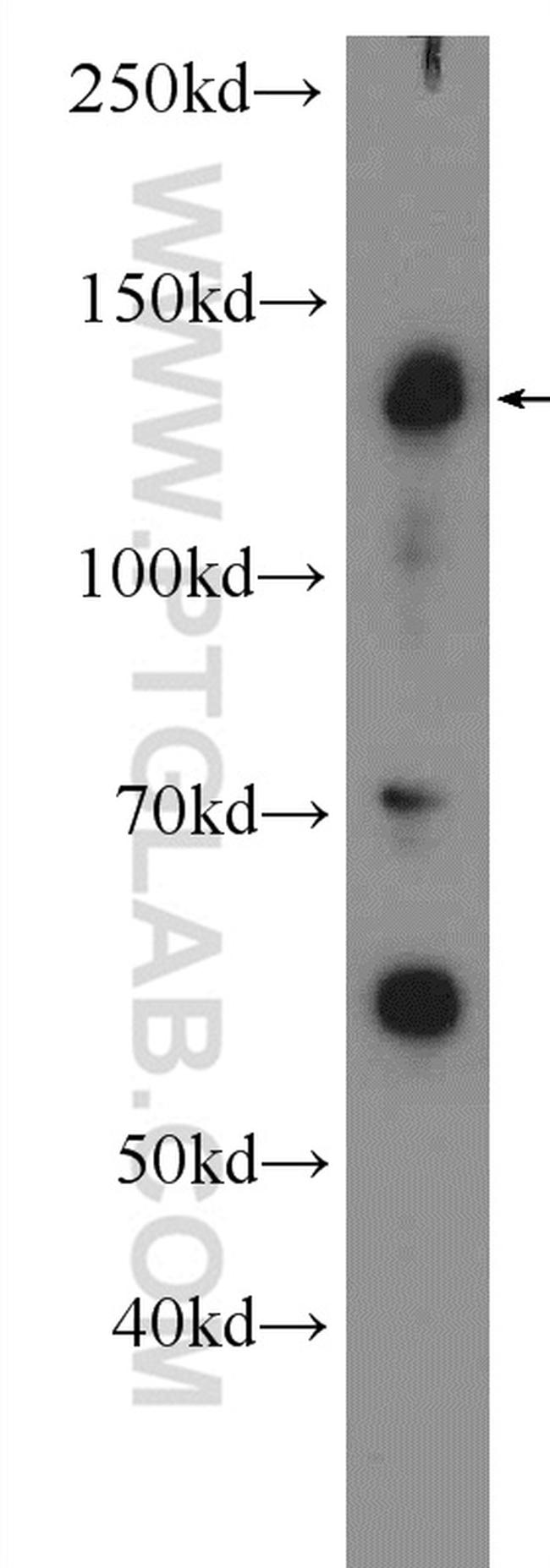 NFATC3 Antibody in Western Blot (WB)