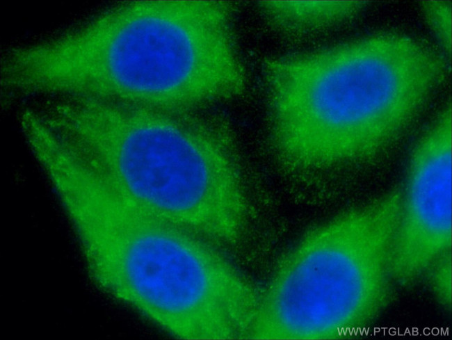 CYP3A4 Antibody in Immunocytochemistry (ICC/IF)