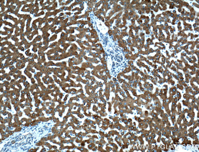 CYP3A4 Antibody in Immunohistochemistry (Paraffin) (IHC (P))