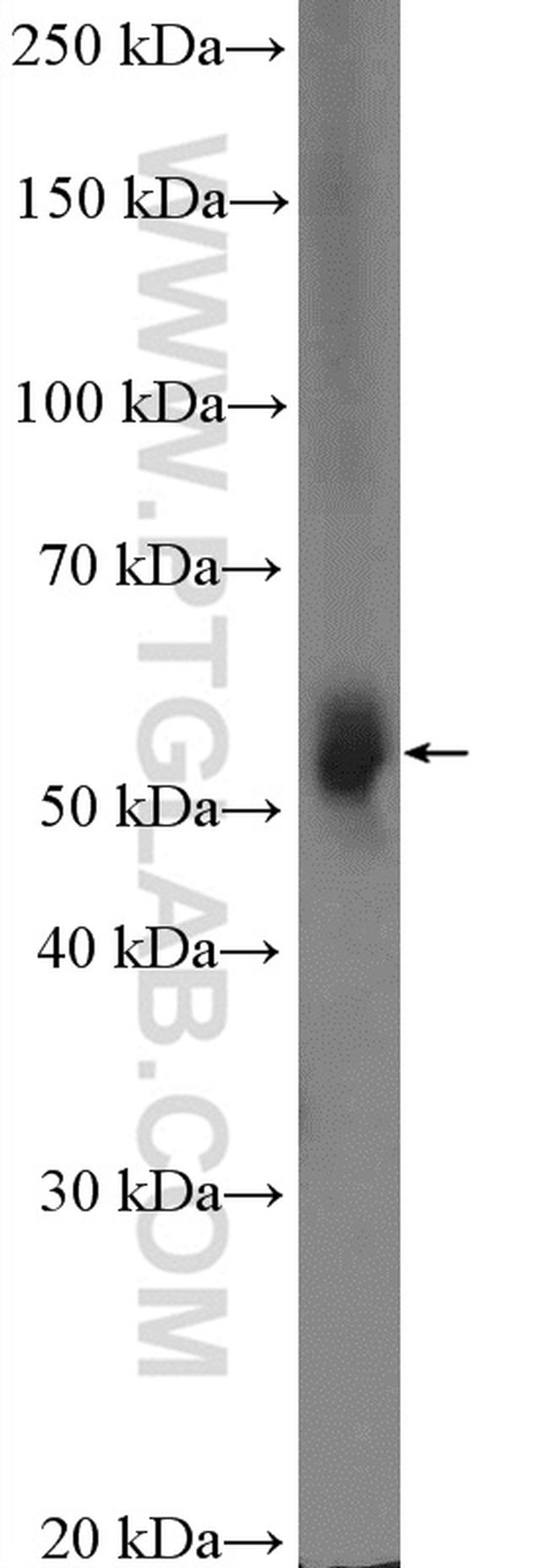 CYP3A4 Antibody in Western Blot (WB)