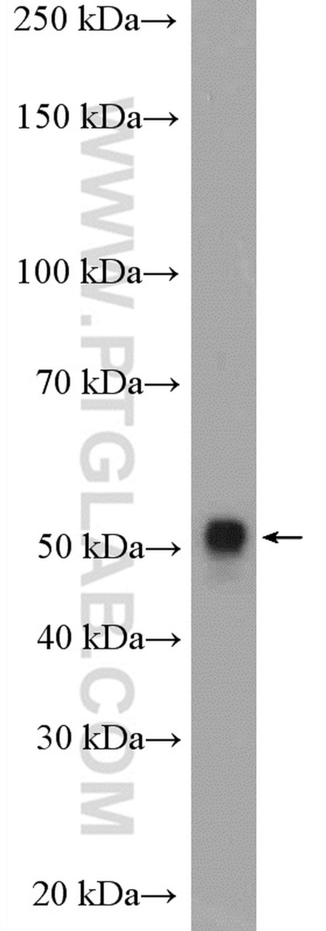 CYP3A4 Antibody in Western Blot (WB)