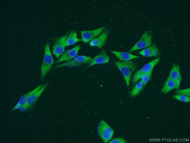 RPS8 Antibody in Immunocytochemistry (ICC/IF)