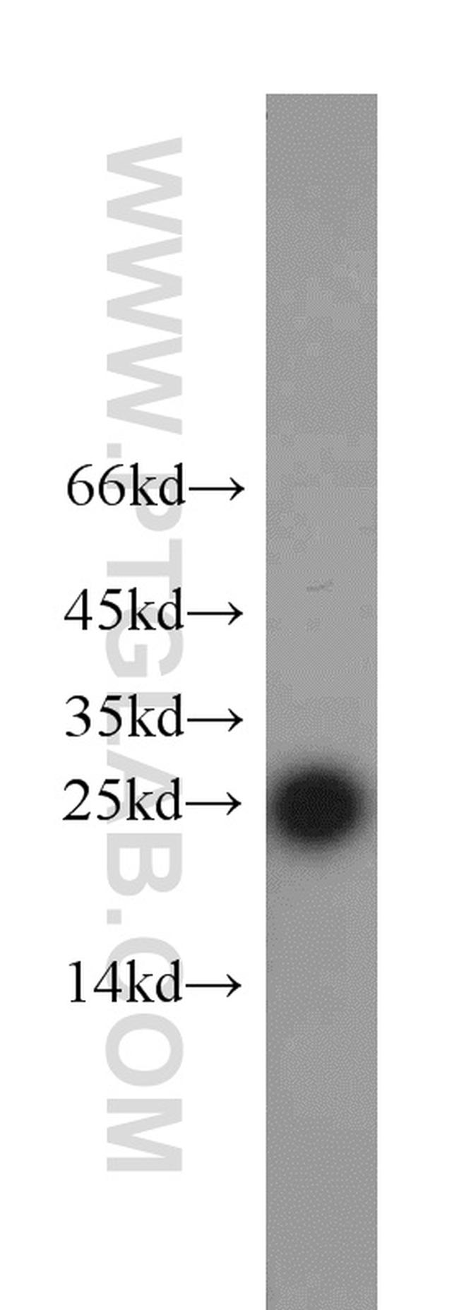 RPS8 Antibody in Western Blot (WB)