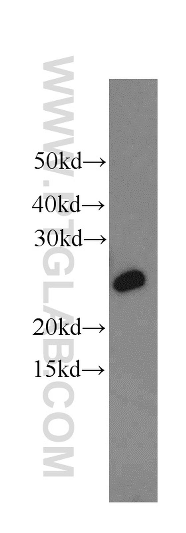 RPS8 Antibody in Western Blot (WB)