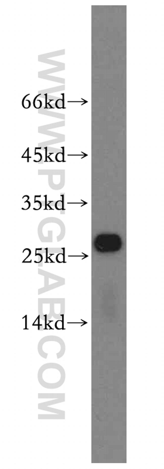 RPS8 Antibody in Western Blot (WB)