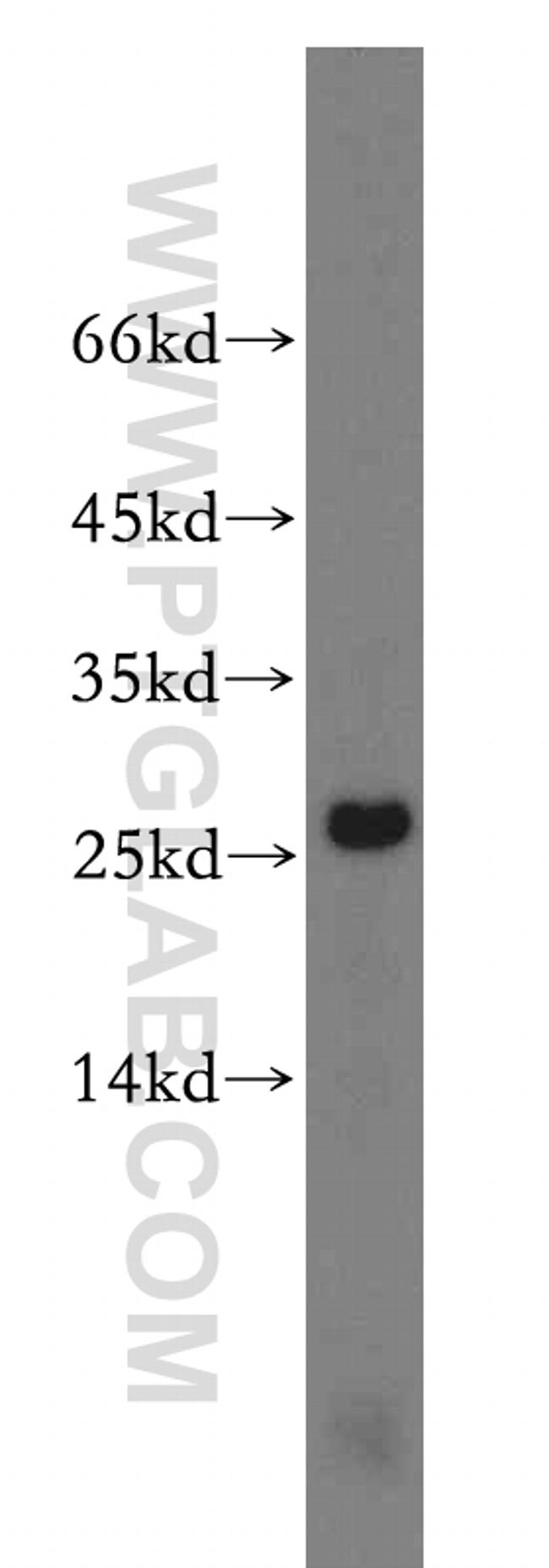 RPS8 Antibody in Western Blot (WB)