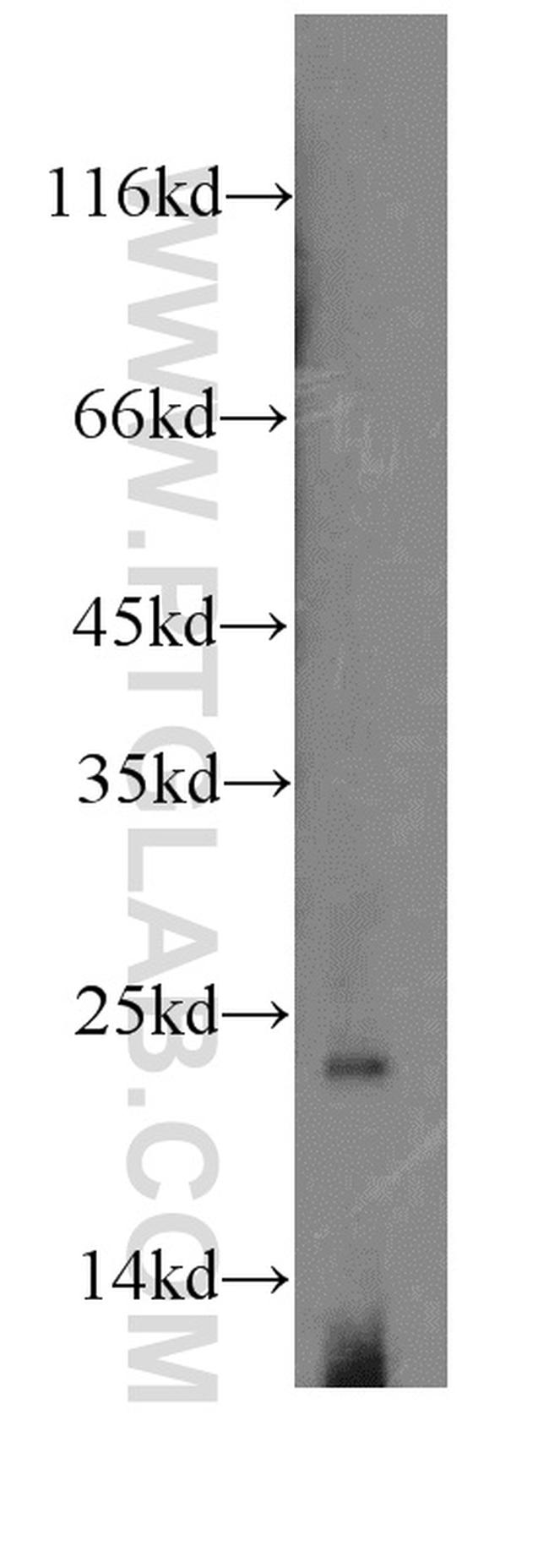 RPS8 Antibody in Western Blot (WB)