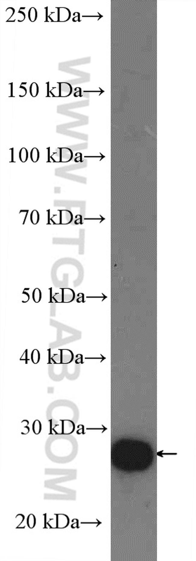 RPS8 Antibody in Western Blot (WB)