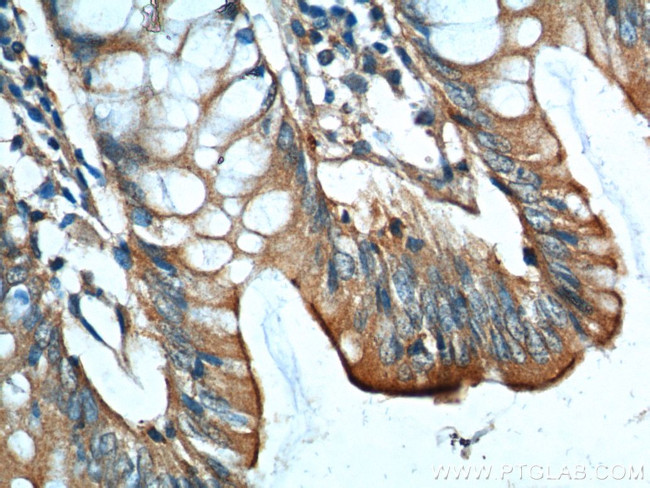 GIPR Antibody in Immunohistochemistry (Paraffin) (IHC (P))