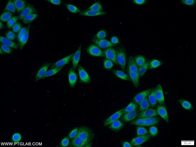 PDIA6 Antibody in Immunocytochemistry (ICC/IF)