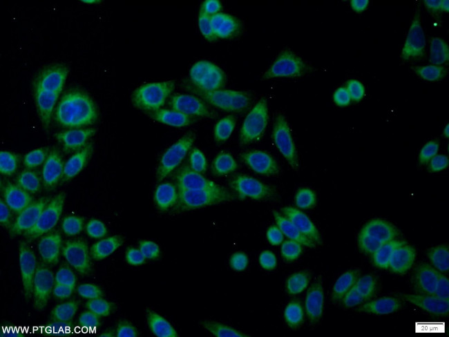 PDIA6 Antibody in Immunocytochemistry (ICC/IF)