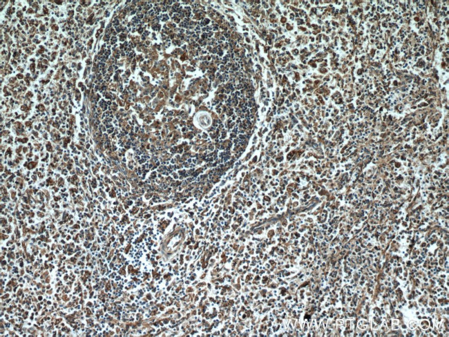 PDIA6 Antibody in Immunohistochemistry (Paraffin) (IHC (P))