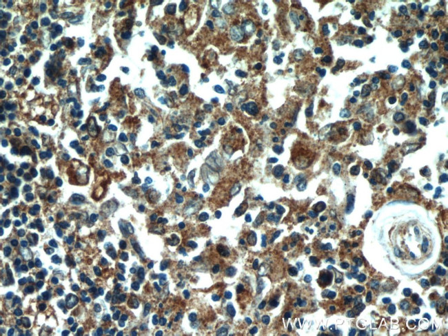 PDIA6 Antibody in Immunohistochemistry (Paraffin) (IHC (P))