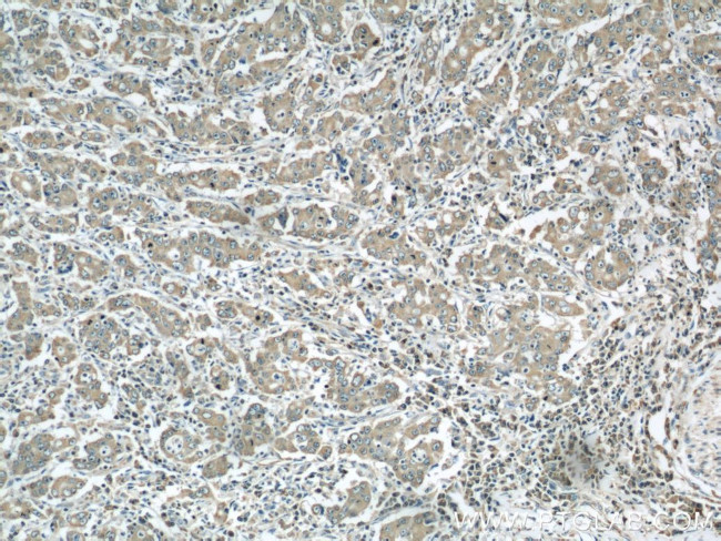 PDIA6 Antibody in Immunohistochemistry (Paraffin) (IHC (P))