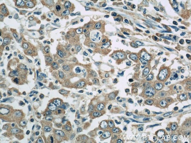 PDIA6 Antibody in Immunohistochemistry (Paraffin) (IHC (P))