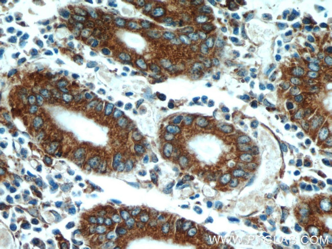 PDIA6 Antibody in Immunohistochemistry (Paraffin) (IHC (P))