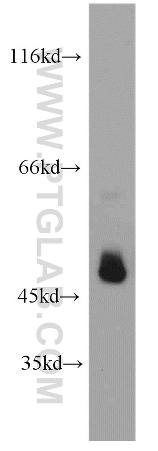 PDIA6 Antibody in Western Blot (WB)