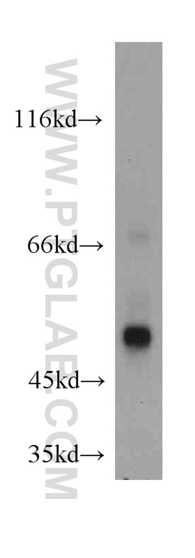 PDIA6 Antibody in Western Blot (WB)