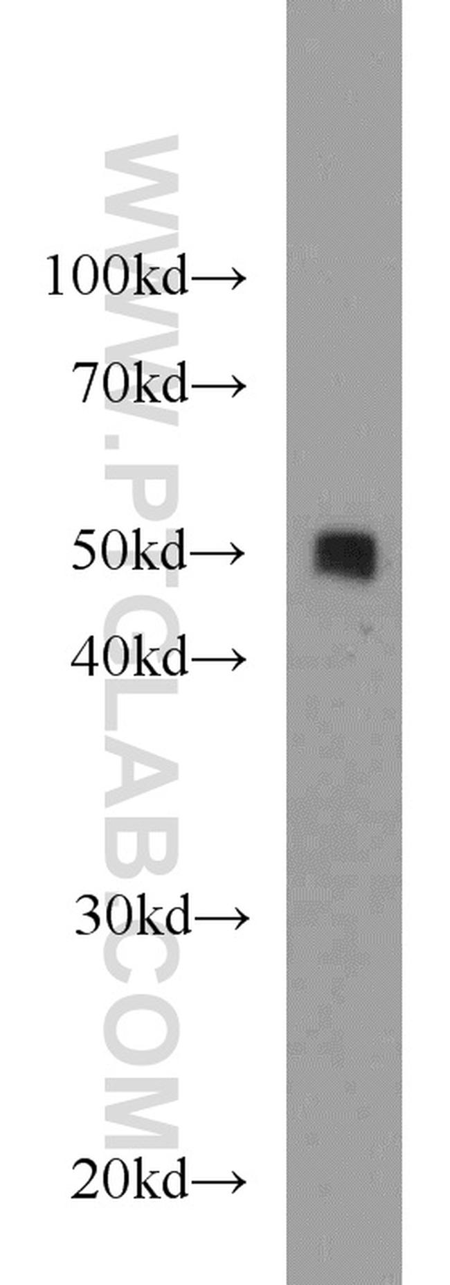 PDIA6 Antibody in Western Blot (WB)