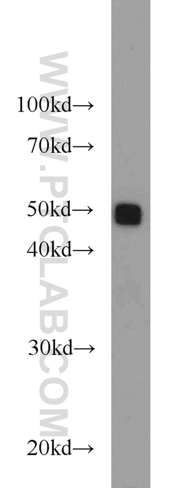 PDIA6 Antibody in Western Blot (WB)