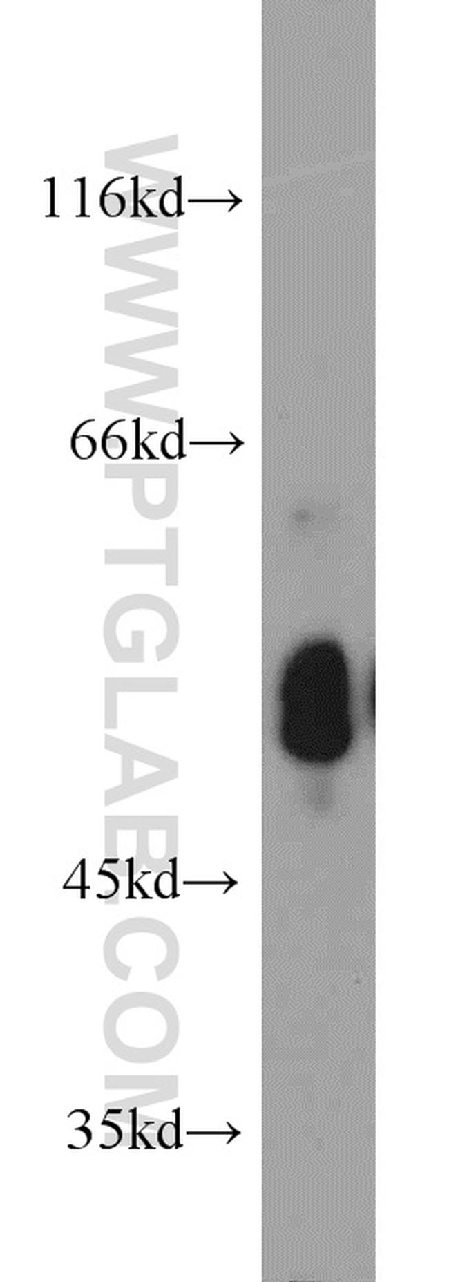 PDIA6 Antibody in Western Blot (WB)