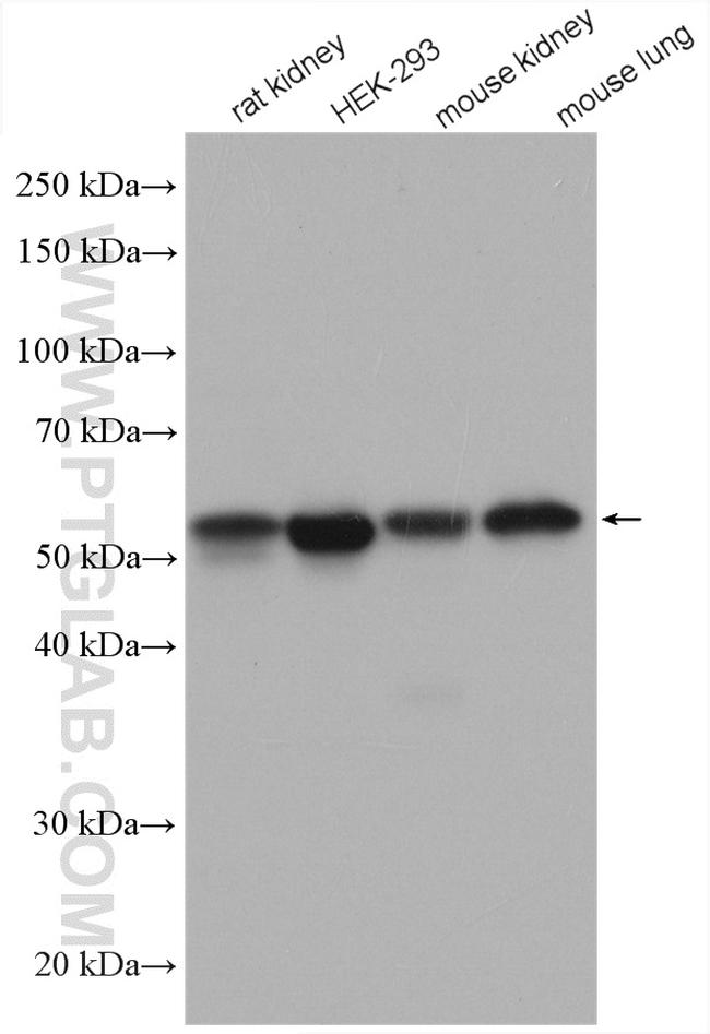 PDIA6 Antibody in Western Blot (WB)