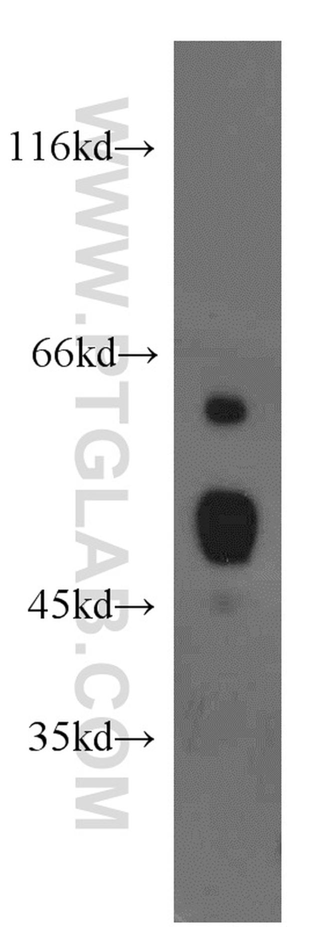 PDIA6 Antibody in Western Blot (WB)