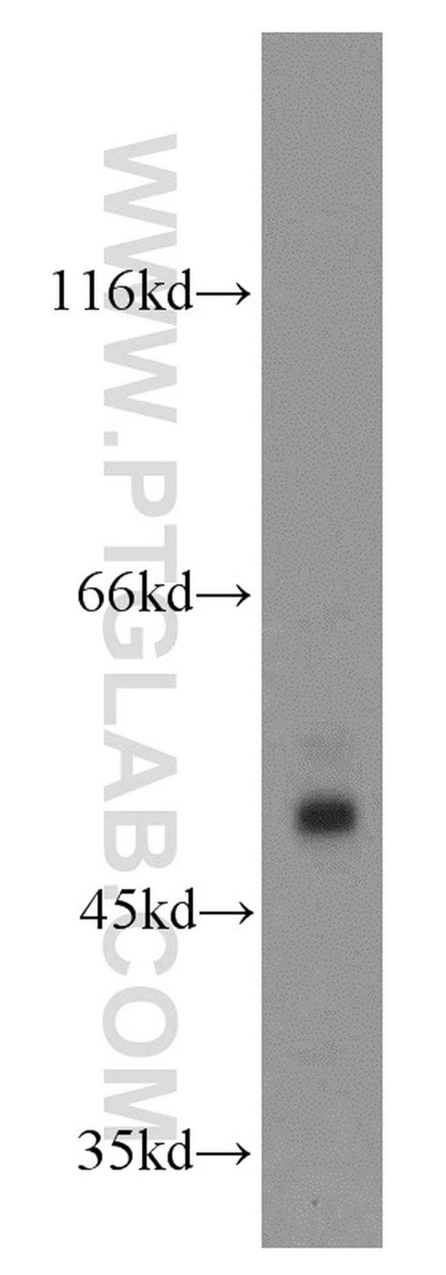 PDIA6 Antibody in Western Blot (WB)