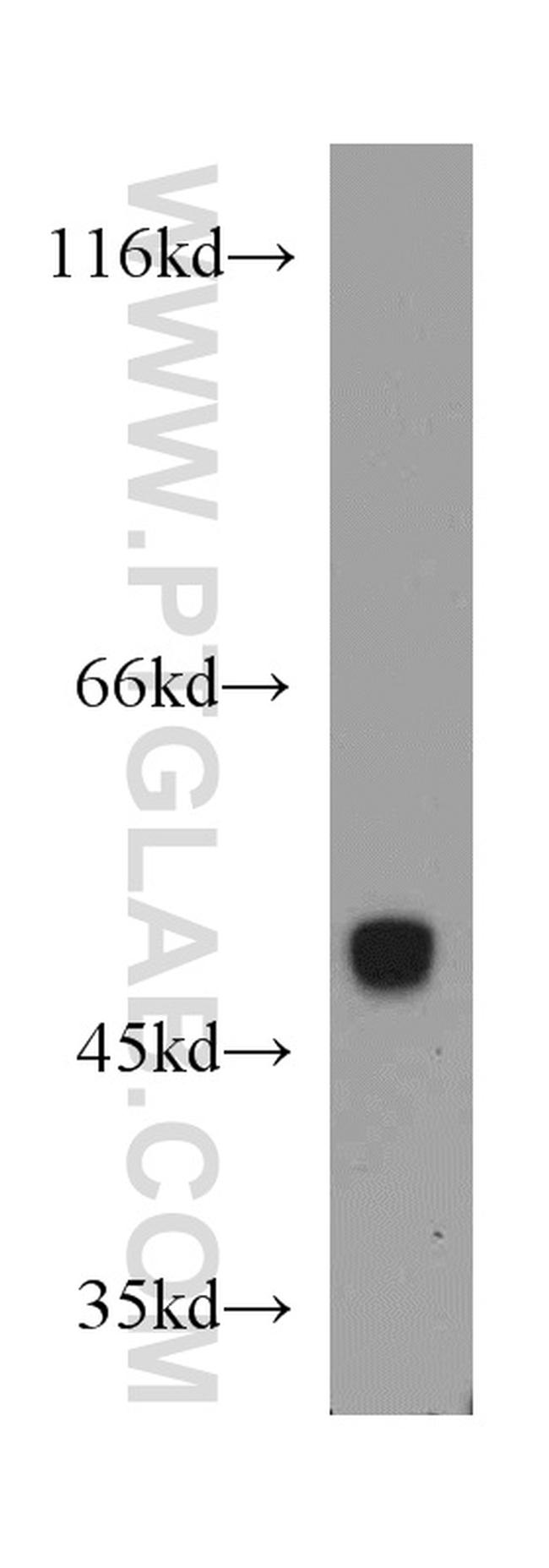 PDIA6 Antibody in Western Blot (WB)