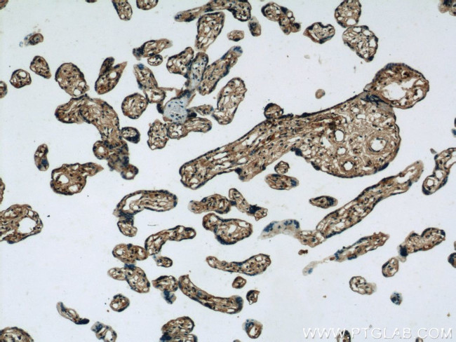 TRPC6 Antibody in Immunohistochemistry (Paraffin) (IHC (P))