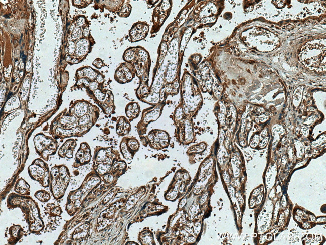 TRPC6 Antibody in Immunohistochemistry (Paraffin) (IHC (P))