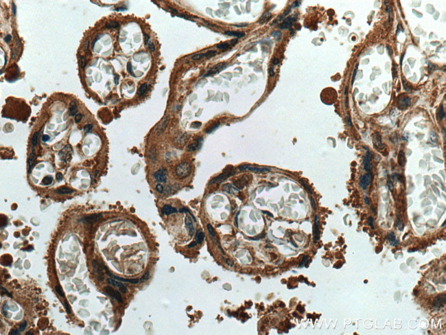 TRPC6 Antibody in Immunohistochemistry (Paraffin) (IHC (P))