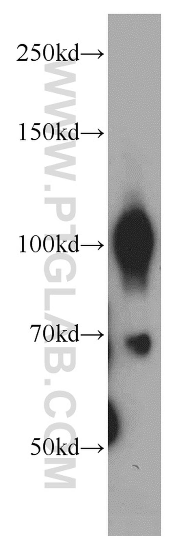 TRPC6 Antibody in Western Blot (WB)