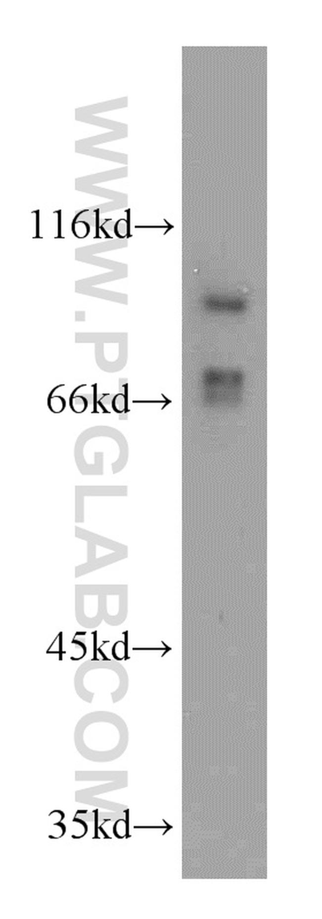 TRPC6 Antibody in Western Blot (WB)