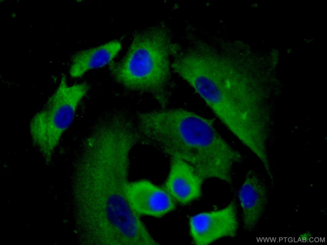 MMP28 Antibody in Immunocytochemistry (ICC/IF)