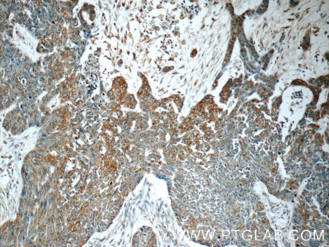 MMP28 Antibody in Immunohistochemistry (Paraffin) (IHC (P))