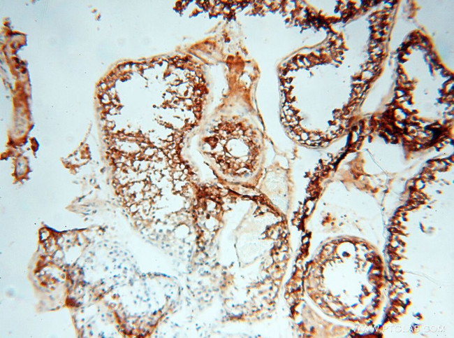 MMP28 Antibody in Immunohistochemistry (Paraffin) (IHC (P))