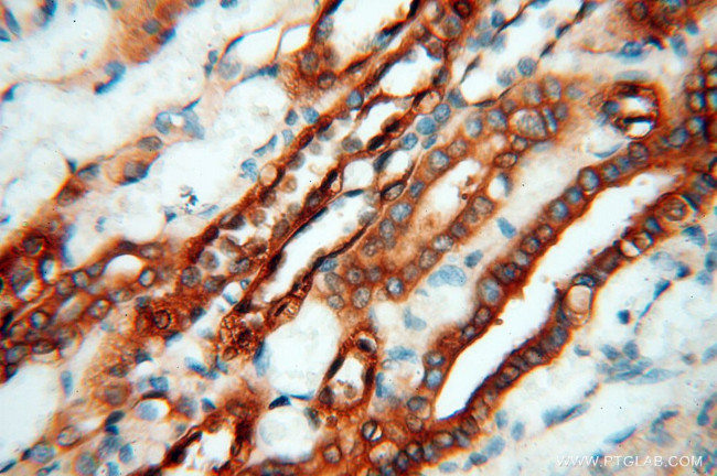 MMP28 Antibody in Immunohistochemistry (Paraffin) (IHC (P))