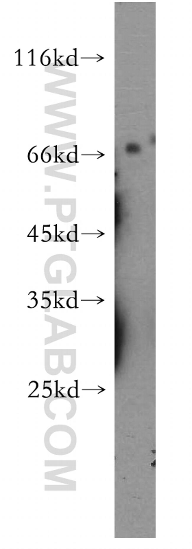 MMP28 Antibody in Western Blot (WB)