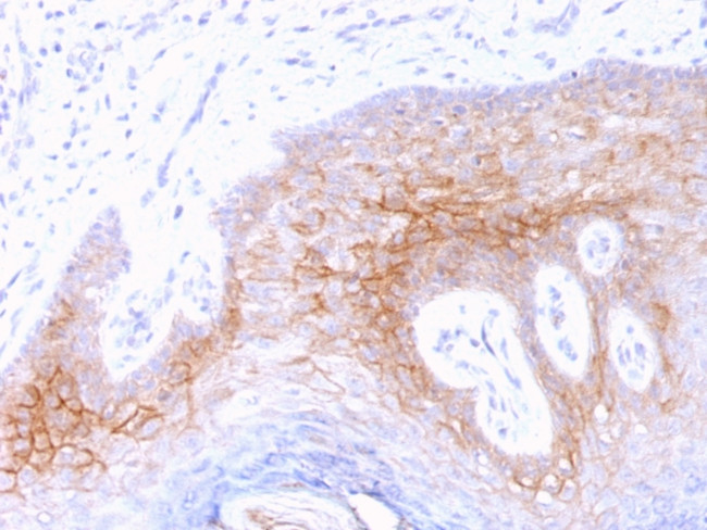 Desmocollin-2/3 Antibody in Immunohistochemistry (Paraffin) (IHC (P))