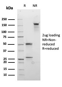 Desmocollin-2/3 Antibody in SDS-PAGE (SDS-PAGE)