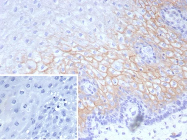 Desmocollin-2/3 Antibody in Immunohistochemistry (Paraffin) (IHC (P))