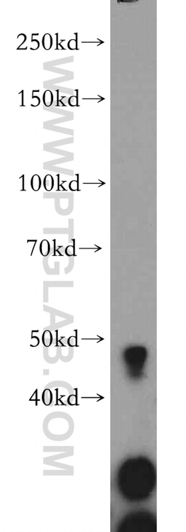 GADL1 Antibody in Western Blot (WB)