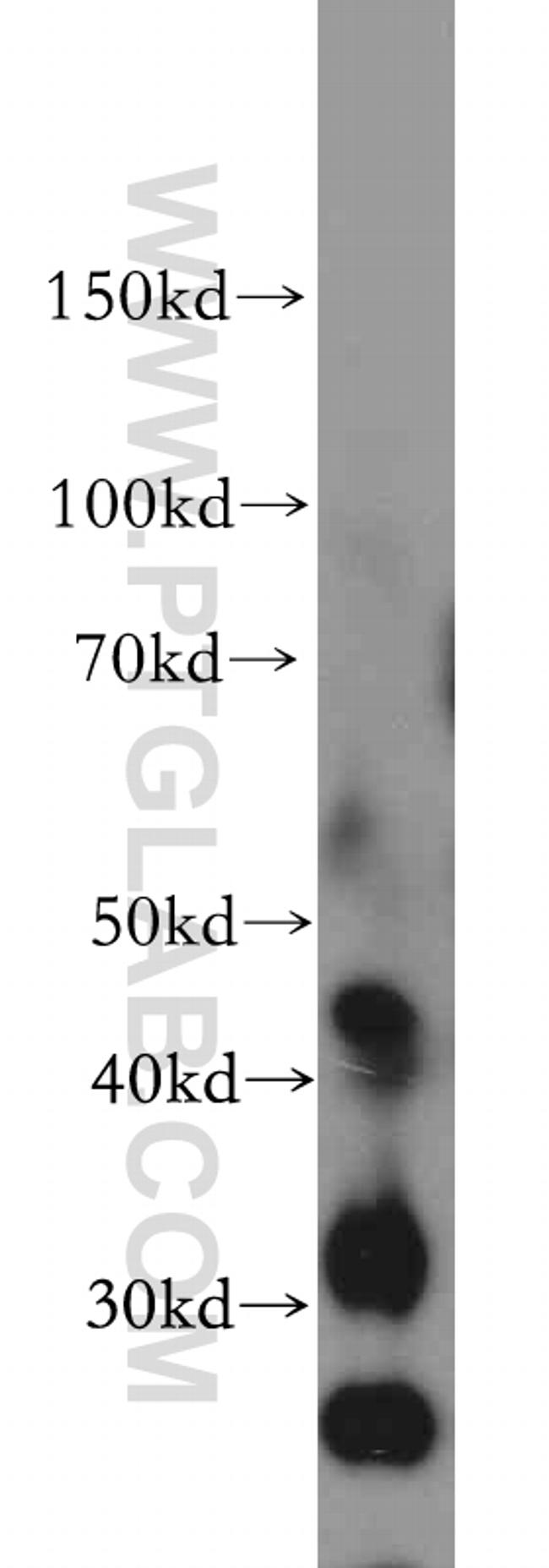 GADL1 Antibody in Western Blot (WB)