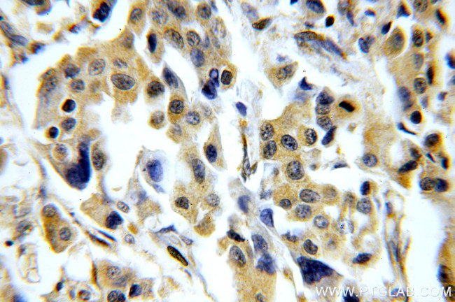 CHST3 Antibody in Immunohistochemistry (Paraffin) (IHC (P))