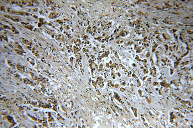 CHST3 Antibody in Immunohistochemistry (Paraffin) (IHC (P))